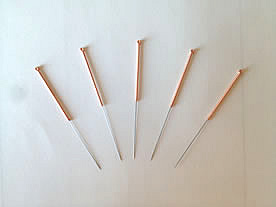 Traditional Chinese Acupuncture